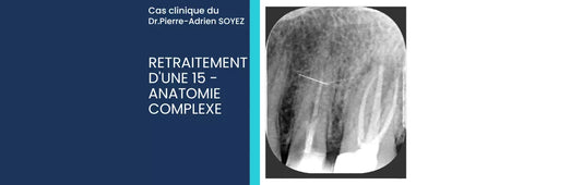 Cas Clinique : Retraitement d'une 15 - Anatomie complexe