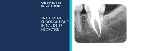 Cas Clinique : Traitement endodontique initial de 37 nécrosée (configuration canalaire en C)