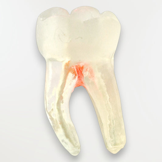 Simulateur Molaire Mandibulaire Avec perforation