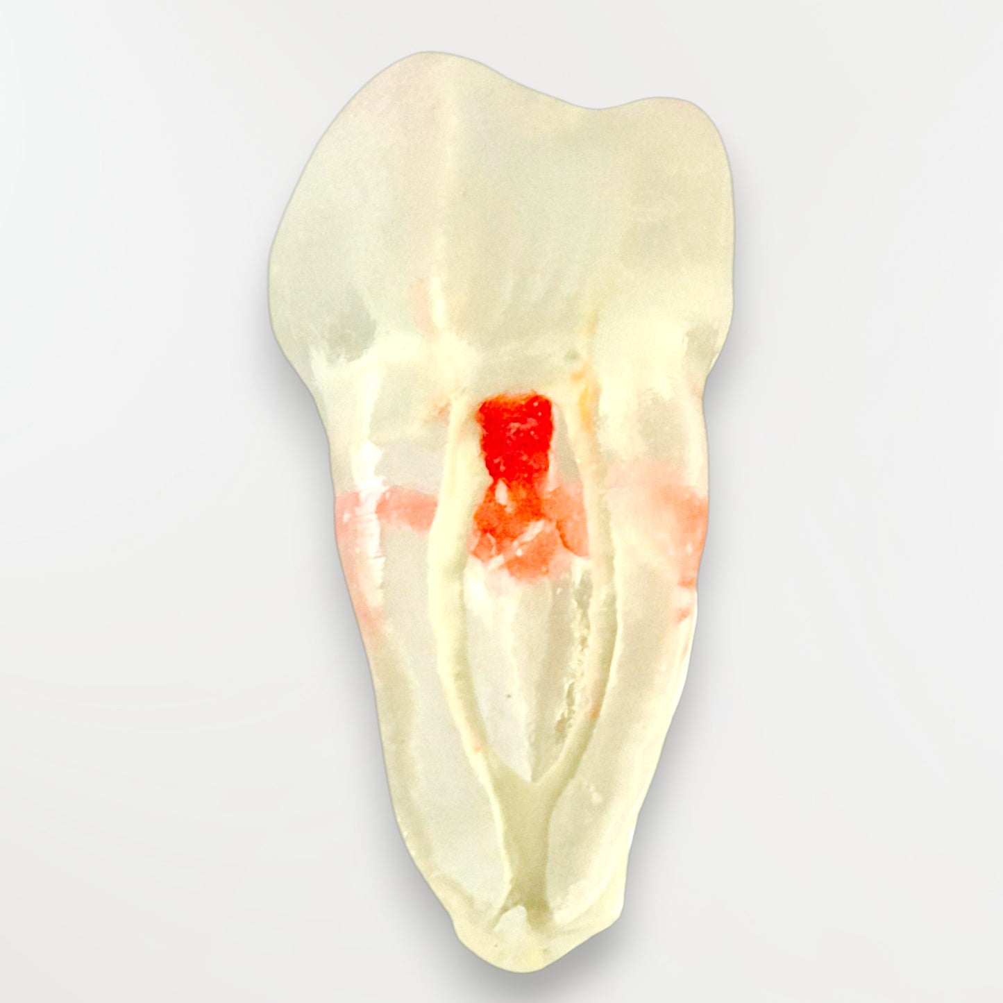 Simulateur Molaire Mandibulaire Avec perforation