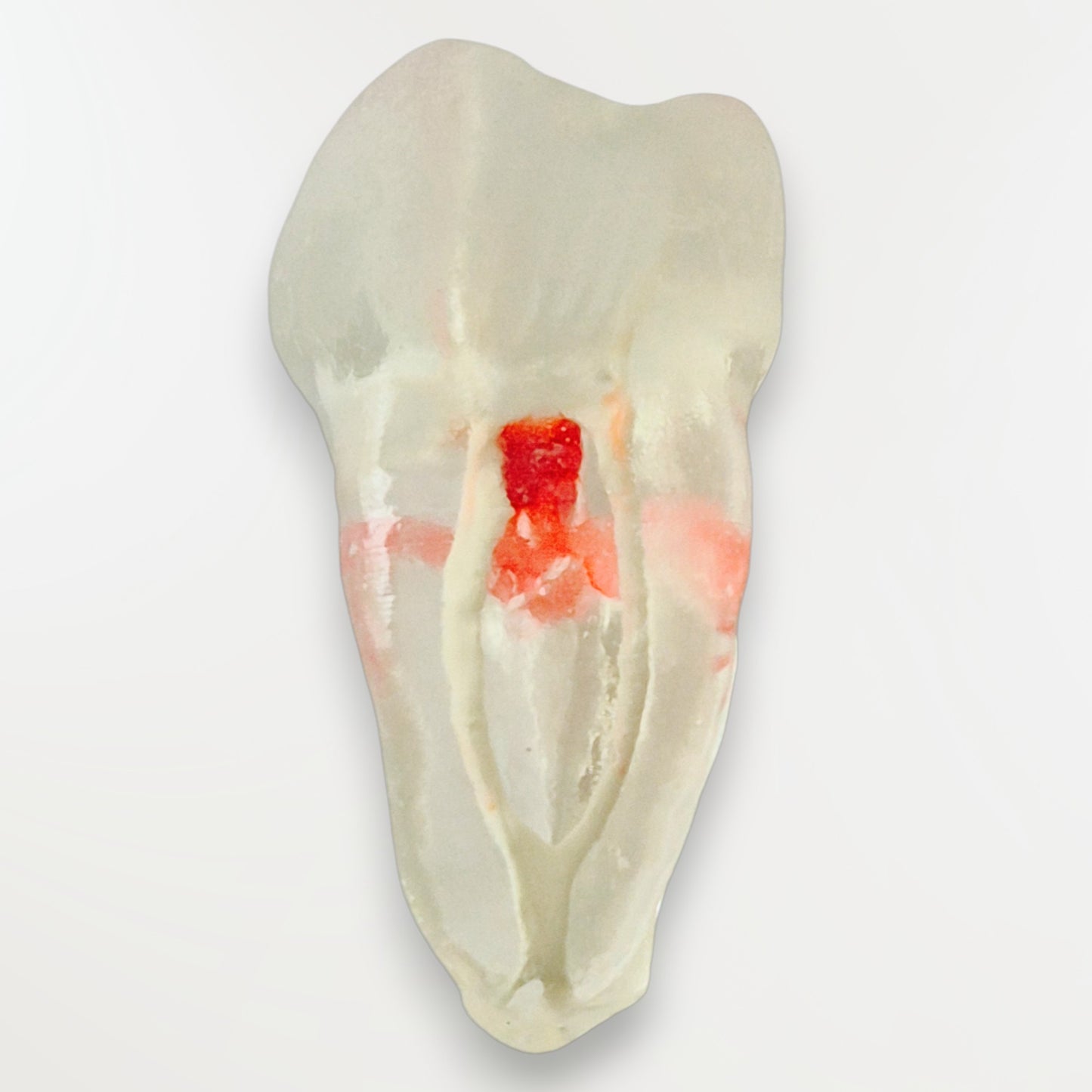 Simulateur Molaire Mandibulaire Avec perforation