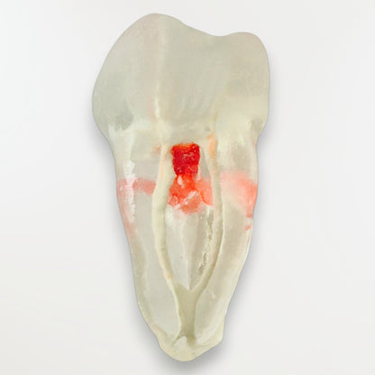 Simulateur Molaire Mandibulaire Avec perforation