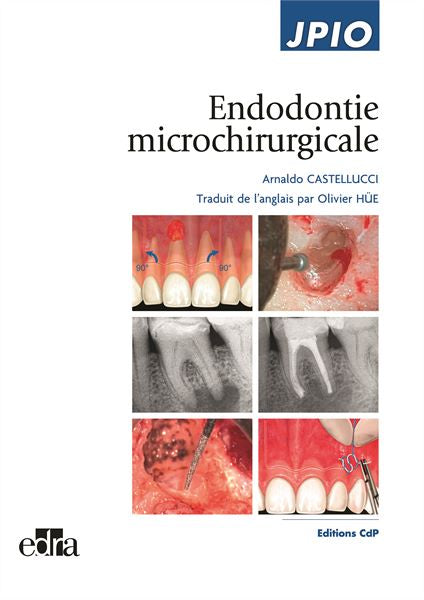 Endodontie Micro Chirurgicale (Arnaldo Castelucci)